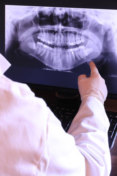 Best Emergency Treatment for Oral Infections in Medina, TN