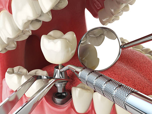 Best Urgent Dental Care for Toothaches in Medina, TN